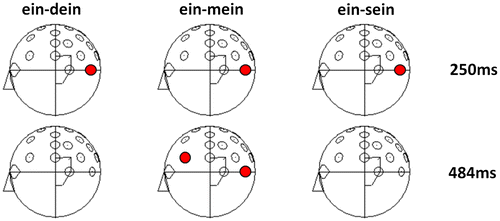 Figure 2. Sample t-maps demonstrating that at early time intervals all possessive pronouns elicited significantly different electrophysiological activity compared to the no-personal pronoun “ein” (a). Later, here exemplified at the maximum effect (484 ms), only processing of the self possessive pronoun “mein” (my) differs from the processing of the non-personal pronoun “ein” (a).