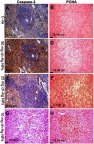 Figure 6 Immunohistochemical expression of caspase-3 and PCNA in the spleen sections in different groups showing negative caspase-3 and PCNA protein expression in the control negative group (A and B). Strong positive caspase-3 and negative PCNA protein expression in the group treated with 50 mg/kg bwt Ch-AgNPs (C and D). Moderate positive caspase-3 and PCNA protein expression in the group treated with 25 mg/kg bwt Ch-AgNPs (E and F). Negative caspase-3 and mild positive PCNA protein expression in the group treated with 10 mg/kg bwt Ch-AgNPs (G and H).Abbreviations: bwt, body weight; Ch-AgNPs, chitosan-coated silver nanoparticles.