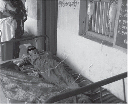 Figure 1. Young female patient with visceral leishmaniasis receiving liposomal amphotericin B infusion at Vaishali District Hospital, Bihar State, India.