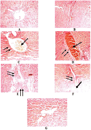 Figure 4.  Histopathological examination of Hematoxylin and eosin stained liver section of normal and experimental rats (each group containing 6 rats). with magnification × 400. A. Normal, B. NaAsO2 treated (6 mg./kg. b wt.) C. NaAsO2 (9 mg./kg. b wt.) treated, D-E. NaAsO2(12 mg./kg. b wt.), F. NaAsO2+Free QC treated, G. NaAsO2+Liposomal QC treated, ↓↓, fibrosis; ↓, congested central vein; ↓, Fatty metamorphosis.