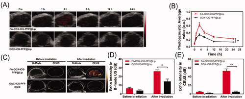 Figure 7. In vivo dual-modal imaging. (A) Photoacoustic images of tumors in Y79-tumor-bearing mice after intravenous injection of FA-DOX-ICG-PFP@Lip and DOX-ICG-PFP@Lip at different times. (B) Photoacoustic values of tumors in Y79-tumor-bearing mice at corresponding time points. (C) Ultrasound images of tumors in Y79-tumor-bearing mice after injection of FA-DOX-ICG-PFP@Lip and DOX-ICG-PFP@Lip before and after laser irradiation. (D) Corresponding echo intensities at tumors in Y79-tumor-bearing mice before and after laser irradiation (**p<.01).