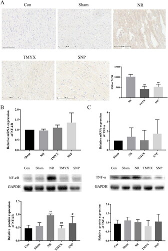 Figure 7. The effects of TMYX on inflammatory signaling pathway in NR rats. (A) Effect of TMYX on myeloperoxidase MPO in NR rats (×200, n = 3). (B) Effect of TMYX on the expression of the NF-κB gene and protein in NR rats. (C) Effect of TMYX on the expression of the TNF-α gene and protein in NR rats. The data are expressed as the mean ± SD; n = 3 animals/group; **p < 0.01 vs. Sham group; #p < 0.05, ##p < 0.01 vs. NR group.