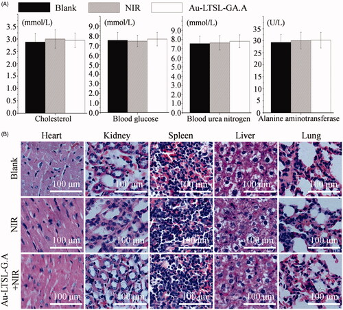 Figure 10. The potential in vivo toxicity evaluation. (A) Blood biochemistry data including liver function markers, kidney function markers, blood glucose, and blood lipids. (B) H&E-stained images of major organs. Each value represents the mean ± SD (n = 3).