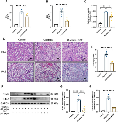 Figure 5 SSF protects renal function and reduces pathological damage of kidneys in cis-AKI mice. SSF protects renal function and reduces pathological damage of kidneys in cis-AKI mice. (A and B) Quantitative analysis of SCr and BUN (n=6 in each group). (C) The ratio of kidney weight to body weight when mice were sacrificed. (D) Representative images of kidneys in mice by H&E and PAS staining. Magnification: 400×. (E) Tubular injury score by H&E staining, no injury=0; ≤25% injury=1; 25%~50% injury=2; 50%~75 injury=3; 75%~100% injury=4. (F) The expressions of NGAL and KIM-1 by WB (n=4 in each group). (G and H) The quantitative analysis of NGAL and KIM-1 by WB. All data are shown as mean ± SEM (one-way ANOVA). **p<0.01, ***p<0.001, ****p<0.0001.