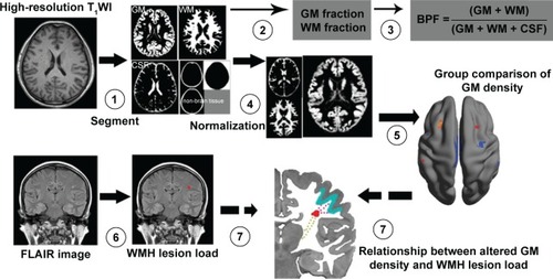 Figure 1 Flowchart of density analysis of normal-appearing gray matter in the healthy middle-aged brain with white matter hyperintense (WMH) lesion.