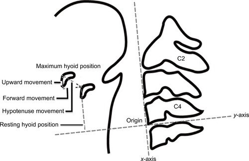 Figure 2 Schema of a lateral view of hyoid bone and neck with measuring point.