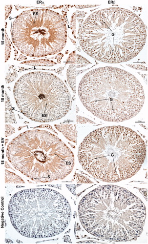 Figure 6. Immunolocalization of estrogen receptor alpha (ESR1/ERα) and estrogen receptor beta (ESR2/ERβ) in rat testis. Positive immunostaining for ESR1 was observed in Sertoli cell nuclei (S), Leydig cell nuclei (L), and elongated spermatids (ES). The intensity of ESR1 immunostaining appeared weaker in 18 month control animals compared to 15 month or 18 month estrogen-treated (EV) animals. Positive immunostaining for ESR2 was observed primarily in developing germ cells (G) prior to the elongated spermatid stage. The intensity of ESR2 immunostaining appeared similar between all groups. No immunostaining was observed in negative control sections incubated with pre-absorbed primary antibody. Bar = 50 µm.