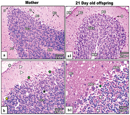 Figure 6. Images from histological sections of cerebellar cortex of control and IS mother’s rats (panels a&b) and their offspring at PND21 (b&b1) respectively. The cerebellar cortex of IS mothers rats and their pups showing fragmented pia matter (white asterisk), vacuolated basket and granular cells (white arrow heads), nonadjacent granular cels (black asterisk). Also, some Purkinje cells appear lysed (yellow asterisk), hypertrophied (green asterisks) and pyknotic (PPC). (H&E stain, scale bar: 25µm).
