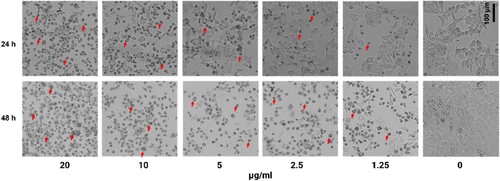 Figure 2. The morphological changes of DTN-treated HCT-116 cells (0–20 µg/ml) at 24 and 48 h. Red arrows indicate apoptotic cells by formation of cell shrinkage, and apoptotic fragments.