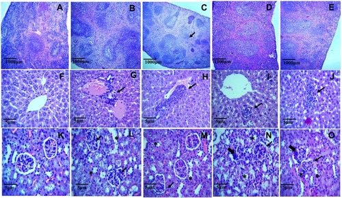Figure 11 Microphotographs of histopathological sections of SeNPs-administered (2.5, 5, 10, and 20 mg/kg) mice spleen at 10x magnification. (A) Healthy control showing normal splenic architecture with well-defined red and white pulp areas. (B–E) Spleen of SeNPs-administered mice preserved the normal splenic architecture in all groups, respectively. Microphotographs of histopathological sections of SeNPs-administered (2.5, 5, 10, and 20 mg/kg) mice liver at 40x magnification. (F) Liver section of healthy control mice with intact cellular morphology, normal hepatocytes, and kupffer cells. (G–J) SeNPs administration led to occasional mononuclear lymphocytic cellular infiltration (arrows) along with normal cellular morphology at all the tested doses. Microphotographs of histopathological sections of SeNPs-administered (2.5, 5, 10, and 20 mg/kg) mice kidney at 40x magnification. (K) kidney section of healthy mice showed normal morphology with intact glomeruli (black arrow) and tubular structures (*). (L–O) Normal morphology of kidney at the doses of 2.5 and 5 mg/kg but mild cellular infiltration was observed in the glomerular surroundings (thick arrows) at 10 and 20 mg/kg tested doses.
