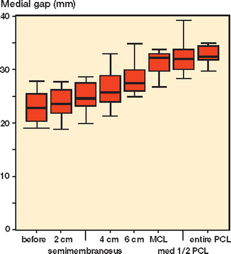 Figure 6. Medial gap in extension with valgus stress;mean value with lowest and highest values.