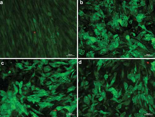 Figure 2. Fluorescence microscopic visualization of live/dead assay after 28 days of adipogenic differentiation of human adipose-derived stem cells. Vital cells with numerous large lipid vacuoles stained green, dead cells stained read. Overlay at 20x magnification, scale bar: 50 µm. (a) undifferentiated control (GM); (b) standard differentiation media (DM); (c) fourfold glucose concentration (4G); (d) fourfold insulin concentration (4I).