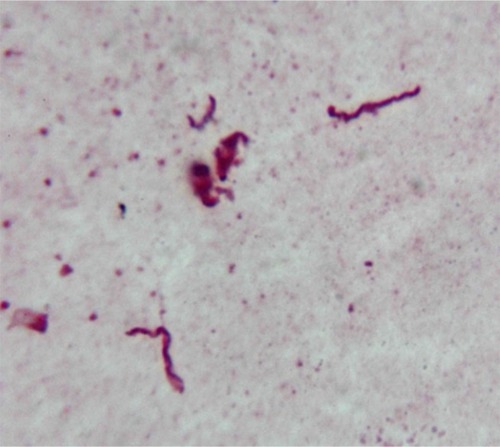 Figure 4 Borrelia spirochetes immunostained with anti-Borrelia antibody in culture of skin sample from Morgellons disease patient.