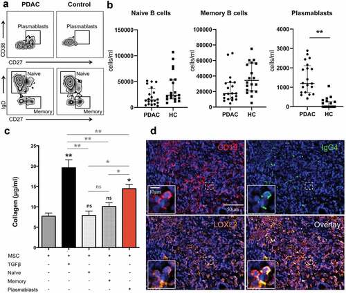 Figure 4. Pro-fibrotic role of plasmablasts/plasma cells in pancreatic adenocarcinoma.