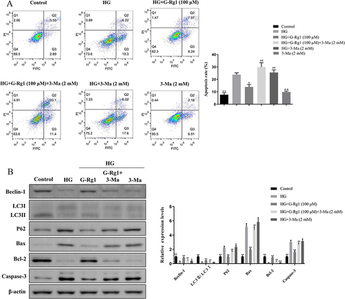 Figure 7 Effect of G-Rg1 combined with 3-MA on cell apoptosis in HG-induced RIN-m5F cells. (A) RIN-m5F cells were treated with 100 μM of G-Rg1 with or without 3-MA for 24h and followed by incubated with HG for 48h. Then, cell apoptotic rates were analyzed by flow cytometry. (B) The expression of the autophagy and apoptosis-associated proteins, Beclin-1, LC3, P62, Bax, Bcl-2, and Caspase-3 was detected by Western blotting. *P<0.05, **P<0.01, compared with the HG group. ##P<0.01, compared with the HG+G-Rg1 (100 μM) group. &P<0.05, &&P<0.01, compared with the HG+G-Rg1 (100 μM)+3-MA (2 mM) group.