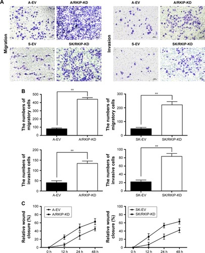 Figure 4 RKIP reduction enhances NSCLC cell migration and invasion abilities.