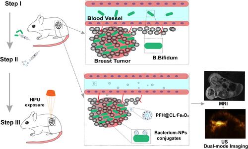 Scheme 1 Schematic illustration of B.bifidum-mediated PFH@CL-Fe3O4 targeted NPs for HIFU ablation and US/MR imaging.