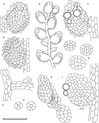 Figure 1  Cololejeunea grossepapillosa. A, Ventral view of leaf. B, Dorsal view of leaf. C, Athecal vegetative branch. D, Stem sections. E, Ventral view of shoot. F, Ventral view of leaf showing gemma initial cells. G, Gemmae. H, Gemmaling. I, Dorsal view of leaf showing gemma initial cells, papillae omitted. Scale bar A–D, F–I: 100 µm; E: 250 µm.