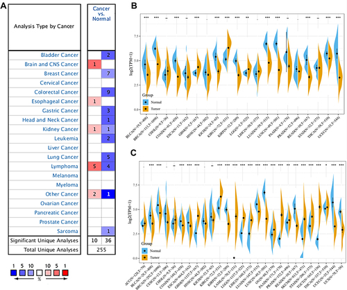 Figure 1 Pan-cancer GIMAP7 expression analysis. (A) The expression of GIMAP7 in different cancers and normal tissues in the Oncomine database. The number in each cell indicates the number of datasets. (B) The expression of GIMAP7 in tumours and adjacent normal tissues in the pan-cancer data of The Cancer Genome Atlas (TCGA) cohorts. (C) GIMAP7 expression in tumour tissues from TCGA cohorts and normal tissues from TCGA and Genotype-Tissue Expression cohorts. *P<0.05, **P < 0.01, ***P< 0.001.