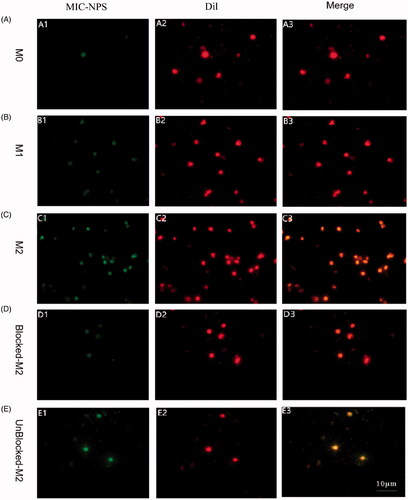 Figure 4. (A) Fluorescent images of M0 cells treated with FITC-loaded MIC-NPs and Dil. (B) Fluorescent images of M1 cells treated with FITC-loaded MIC-NPs and Dil. (C) Fluorescent images of M2 cells treated with FITC-loaded MIC-NPs and Dil. (D) Fluorescent images of M2 cells after blocking the mannose receptor. (E) Fluorescent images of M2 cells without blocking the mannose receptor. FITC-loaded MIC-NPs: nanoparticles of imidazole and mannose modified carboxymethyl chitosan loaded with FITC.