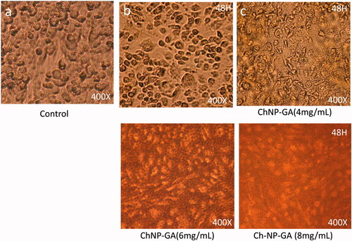 Figure 8. Cancer Cell morphology after treatment of ChNP-GA: The HCT-116 cells analyzed 48 h post-treatments (a) is control; (b) is treated with dose 2 mg/mL, (c) is treated with 4 mg/mL, whereas (d) and (e) are treated with 6 mg/mL and 8 mg/mL. The dose of 4 mg/mL showed complete loss of cell internal organelles and complete disappearance of nucleus. 400× magnifications.