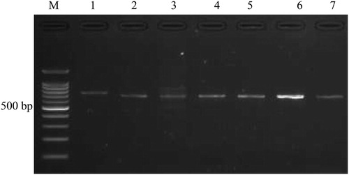 Figure 1. Electrophoregram displaying PCR products (1–7) on 2% agarose gel. M, 100-bp DNA ladder (Promega Inc., Madison, WI, USA). Lanes 1–7 refer to genes GNB-3, GCK, SLC30A, KNJ11, TCF7L2, CDKN2A/B and HNF4A, respectively.