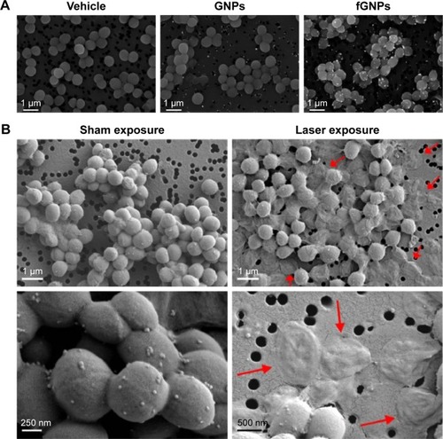 Figure 1 Scanning electron microscope images of MSSA.Notes: (A) Backscattered electron images of MSSA treated with PBG vehicle, nonfunctionalized GNPs, or fGNPs. (B) Secondary electron images showing MSSA treated with fGNPs and then sham exposed or exposed to pulsed laser irradiation at 532 nm. Red arrows indicate damaged bacterial cells. Copyright © 2015. Dove Medical Press. Reproduced from Millenbaugh NJ, Baskin JB, DeSilva MN, Elliot WR, Glickman RD. Photothermal killing of Staphylococcus aureus using antibody-targeted gold nanoparticles. Int J Nanomedicine. 2015;10:1953–1960.Citation28Abbreviations: fGNPs, functionalized GNPs; GNPs, gold nanoparticles; MSSA, methicillin-sensitive Staphylococcus aureus; PBG, phosphate buffered saline containing 1% bovine serum albumin and 10% glycerol.