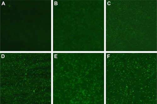 Figure 5 Changes of ROS production in AgNP-treated multidrug-resistant Pseudomonas aeruginosa at different time intervals under fluorescence microscopy with ×400 magnification.Notes: (A) The untreated P. aeruginosa without observable fluorescence. (B–F) Fluorescence observation of the bacteria treated with AgNPs at different points of 0.5, 0.75, 1, 1.5, and 2 hours, respectively, indicating that AgNPs induce ROS production in a time-dependent manner.Abbreviations: AgNP, silver nanoparticle; ROS, reactive oxygen species.