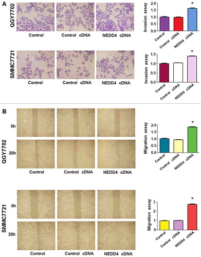 Figure 6. Overexpression of NEDD4 enhanced cell invasion and migration in liver cancer cells. A. Left panel: Invasion assay was conducted by Transwell chambers assay to measure the invasive capacity of liver cancer cells after NEDD4 overexpression. Right panel: Quantitative results are illustrated for panel A. B. Left panel: Wound healing assays were used to detect the motility. Right panel: Quantitative results are illustrated for panel B. * P<0.05 vs control.