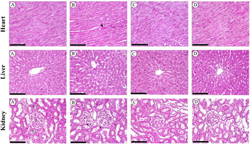 Figure 4. Sections of heart tissues (A–D) showing (A) the control group with normal appearance of myocardial cells, (B) severe damage with hemorrhage between muscle fibers (arrow) in HCD group, (C) less injury and normal myocardial cell morphology with oval-elongate nucleus centrally and homogeneous cytoplasm in LT(10) group, (D) almost normal cardiomyocytes looking in LT(20) group. Sections of hepatic tissues (A–D) showing (A) normal architecture of hepatocytes and central vein in control group, (B) steatosis and infiltration of inflammatory cells in HCD group, (C) incomplete regenerating hepatocytes around the central vein in LT(10) group, (D) complete recovery in hepatocytes with binuclear cells in LT(20) group. Sections of renal cortex (A–D) showing (A) normal appearance of the proximal convoluted tubules [PT], distal convoluted tubules [DT], Bowman's capsule and glomerulus [G] in control group, (B) dilatation in glomerular capillaries (head arrow), increase in glomerular tuft size and expansion in Bowman's space in HCD group, (C) partial improvement in glomeruli and renal tubules in LT(10) group, (D) complete retrieval of glomeruli and renal tubules in LT(20) group. Scale bar = 50 µm.