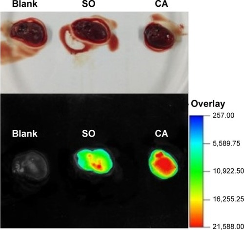 Figure 6 Fluorescence imaging of rats’ hearts 20 minutes after intravenous administration of IR-775 loaded liposomes.Abbreviations: CA, cardiac radiofrequency ablation; SO, sham-operated.
