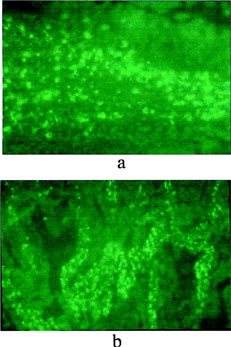 3 Micrographs of intestine samples (a) 1.5 h and (b) 6 h after feeding a single dose of PCEFB/PLGA microspheres.