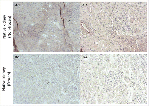 Figure 6. Orcein stain imaging for frozen/thawed and non-frozen native kidney samples at magnifications of 10X (A-1 & B-1) and 20X (A-2 & B-2). Generally, the elastin fibers were damaged as a result of freezing/thawing (affinity for Orcein stain color was lower for frozen/thawed samples which resulted in lighter color in images). Because of fibril damage the structure was more porous and had less integrity as indicated by the white spaces that were more frequent in frozen/thawed samples (arrows show renal corpuscles).