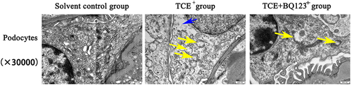 Figure 11 Glomerular podocytes TEM detection (×30,000). Yellow arrow: the vacuolate degeneration of massive mitochondria; blue arrow: podocytes with slightly swelling. Solvent control group mice showed the normal structure of podocytes. In TCE sensitized positive mice, podocytes had light swelling with mitochondria vacuolate degeneration. Mitochondrial injury reduced in TCE+BQ123 sensitized positive mice.