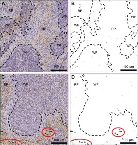 Figure 6 Spleen sections exposed to TUNEL assay reagents and processed using ImageJ for analysis.Notes: (A) Control unadjusted and (B) adjusted images. (C) Experimental unadjusted, and (D) adjusted images.Abbreviations: RP, red pulp; WP, white pulp.