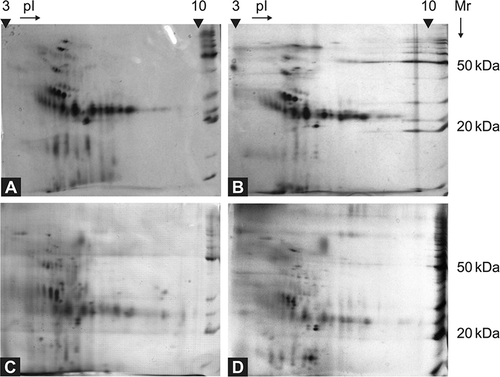Figure 1. Comparison of 2D electrophoreograms of urine samples collected from patients with Fabry disease (A, B) and healthy controls (C, D). The urine samples were analyzed immediately after their collection and short-time centrifugation, using 7 cm polyacrylamide strips, pH 3–10 L, and SDS-PAGE. BenchMarkTM Protein Ladder (Invitrogen, Glasgow, UK) was used as a molecular mass marker.