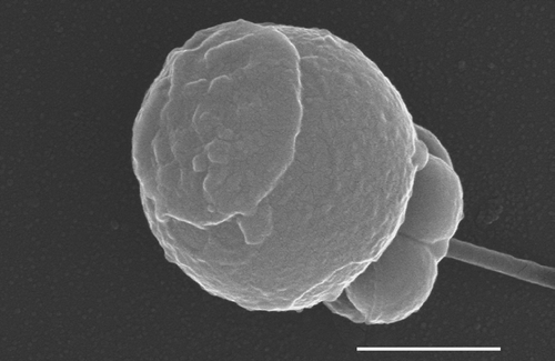 Figure 4. SEM: Mature spermatozoon of L. impatiens. The acrosome occupies a large part of the upper surface. Bar 1 μm.