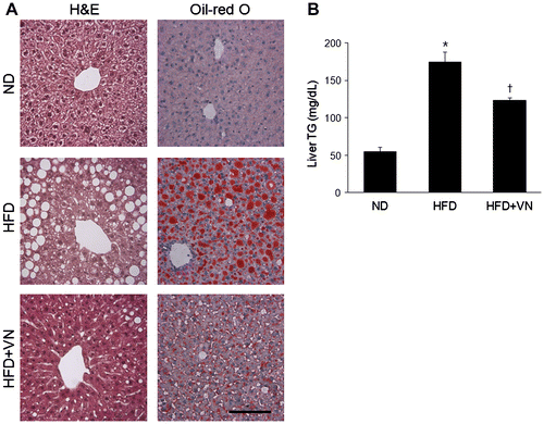 Fig. 3. Effect of the VN extract on hepatic steatosis in HFD-fed mice.Notes: (A) Representative microphotographs of hematoxylin and eosin and Oil Red O staining of the hepatic lipid accumulation. The scale bar shows 100 μm. (B) Concentration of hepatic TG. Data (n = 6 mice per group) are presented as the mean ± SEM.*p < 0.05 vs. ND mice; †p < 0.05 vs. HFD mice.