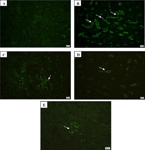 Figure 7. Immunofluorescence investigation of collagen III in kidney tissues showing: (A) mild expression in control group (200×), (B) marked expression in CKD group (200×), (C) moderate expression in SPL group (200×), (D) mild expression in ZnO-NPs group (200×), and (E) mild expression in SPL + ZnO-NPs group (200×).