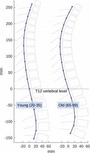 Figure 3. Average group parameters used to rebuild average spine shapes of the young and old groups. Results reflect greater degrees of kyphosis with age.