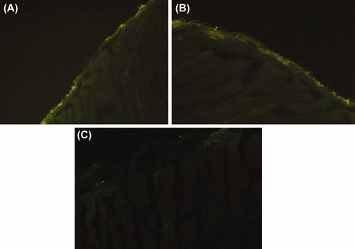 Figure 3. The immunofluorescence microscope images show the peritoneum slides, MSC-IP group (A) MSC-IV group and placebo group (C). GFP labeled-MSCs were observed along the mesothelium line in the MSC-IV and IP group (A) and (B) but were absent in the placebo group (B).