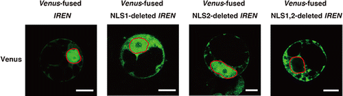 Fig. 2. Impact of NLS1 and NLS2 on the subcellular localization of IREN in rice protoplasts.