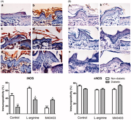 Figure 3. Immunohistochemical staining for iNOS and nNOS in the skin of non-diabetic control (a), diabetic untreated (b), non-diabetic L-arginine-treated (c), diabetic L-arginine-treated (d), non-diabetic M40403-treated (e) and diabetic M40403-treated (f) rats. Data obtained after quantitative evaluation of immunohistochemistry images represent the mean ± SEM. *Comparison with non-diabetic untreated control, *p < .05; **p < .01; ***p < .001. #Comparison with diabetic untreated control, #p < 0.05. Magnification: 40× orig.; insets 63×. iNOS: inducible NOS; nNOS: neuronal NOS.