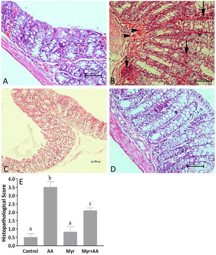 Figure 3. (A-D) Histological findings of colons: (A) Control group showing occasional leucocytes and normal epithelium. (B) AA-induced colitis depicting widespread mucosal damage and mucodepletion. Note also crypt abscess (short arrow), marked inflammatory cell infiltration (long arrows) and massive submucosal congestion (arrowheads). (C) Mry-alone treated group with close appearance to control. (D) Myr pretreatment in AA-treated mice attenuated the extent of severity of colonic cell damage. Original Magnification: 200x (A, B, D) and 100x (C). (E) Scoring of histology sections. Six animals were taken in each group. Results are expressed as mean ± SE. Bars with different letters show statistically significant differences between the groups (p < 0.05).