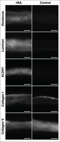 FIGURE 6. Immunofluorescence staining of ECM proteins characteristic of the corneal stroma, expressed by encapsulated keratocytes within compressed collagen gels with or without RA supplementation. All photographs were taken at x200 magnification. Scale bar = 50 µm.