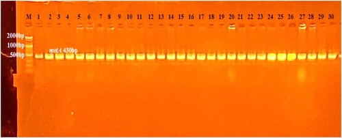 Figure 3. PCR product electrophoresis for motA gene (430 bp) for E. coli in (1.5% agarose) and TBE (1×) at (75 volt/cm2) in 90 min. and marker DNA ladder (100 bp).