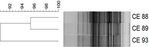 Figure 1 Xba1 restriction patterns of genomic DNA of CE strains, Kolkata, India. Dendrogram was generated by using the unweighted pair group with the arithmetic mean method.