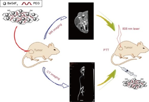 Figure 5 A schematic diagram of magnetic resonance (MR)/computed tomography (CT) imaging and near infrared photothermal therapy (PTT) using the graphene oxide/BaGdF5/polyethylene glycol (PEG) nanocomposites. Reproduced with permission from Zhang H, Wu H, Wang J, et al. Graphene oxide-BaGdF5 nanocomposites for multi-modal imaging and photothermal therapy. Biomaterials. 2015;42:66–77.Citation148 Copyright © 2015 Elsevier.