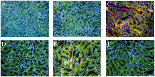 Figure 7. Expression of p-MLKL in RTEC of TCE-sensitized mice by immunofluorescence. (A) Blank control, (B) Vehicle control, (C) TCE+, (D) TCE−, (E) TCE + R7050+ group, (F) TCE + R7050− group. Red: p-MLKL; Green: CK-18; Blue: DAPI. Magnification 400×. Scale bars = 50 μm.