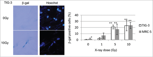 Figure 8. Cellular senescence after low-dose long-term FR. (A) Images of β-gal staining in unirradiated control cells and irradiated 31FR MRC-5 cells with and without NAC treatment. Percentage of β-gal-stained cells in unirradiated control and irradiated 31FR cells with and without NAC treatment.